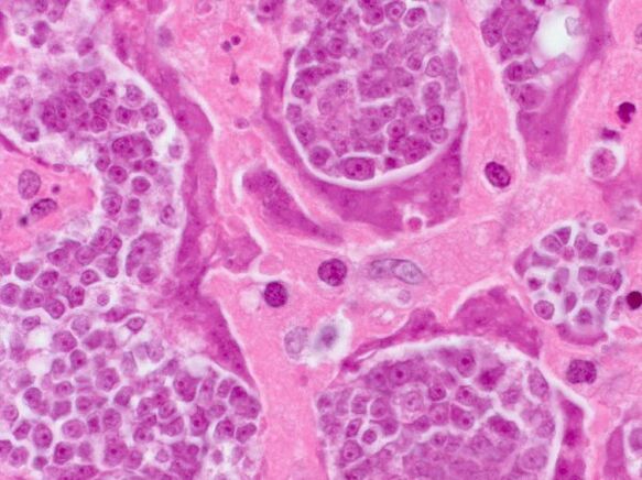 Recherche sur les parasites en une seule personne
