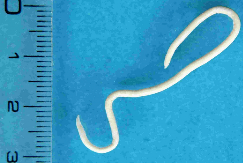 Description des parasites humains
