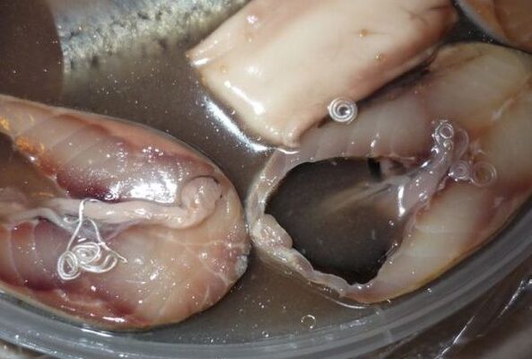 Voies d'infection chez l'homme par des parasites