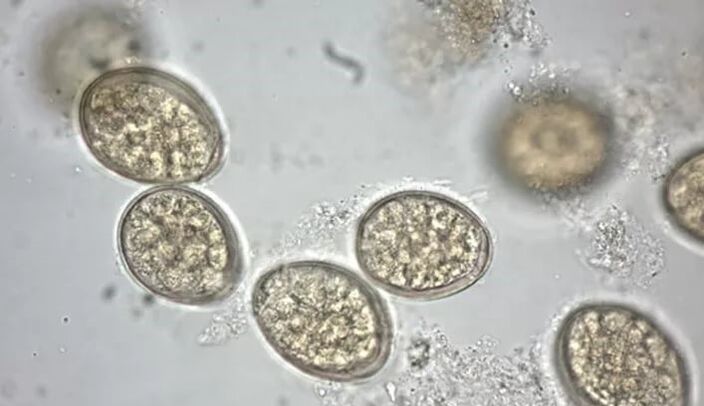 Les parasites au microscope