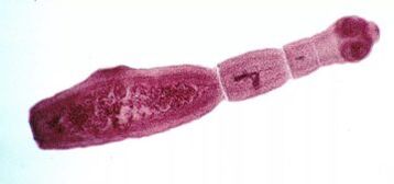 Comment se débarrasser des parasites dans le corps humain